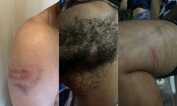 Guilherme Guerra, torcedor do Cruzeiro agredido pela PM no Mineirão